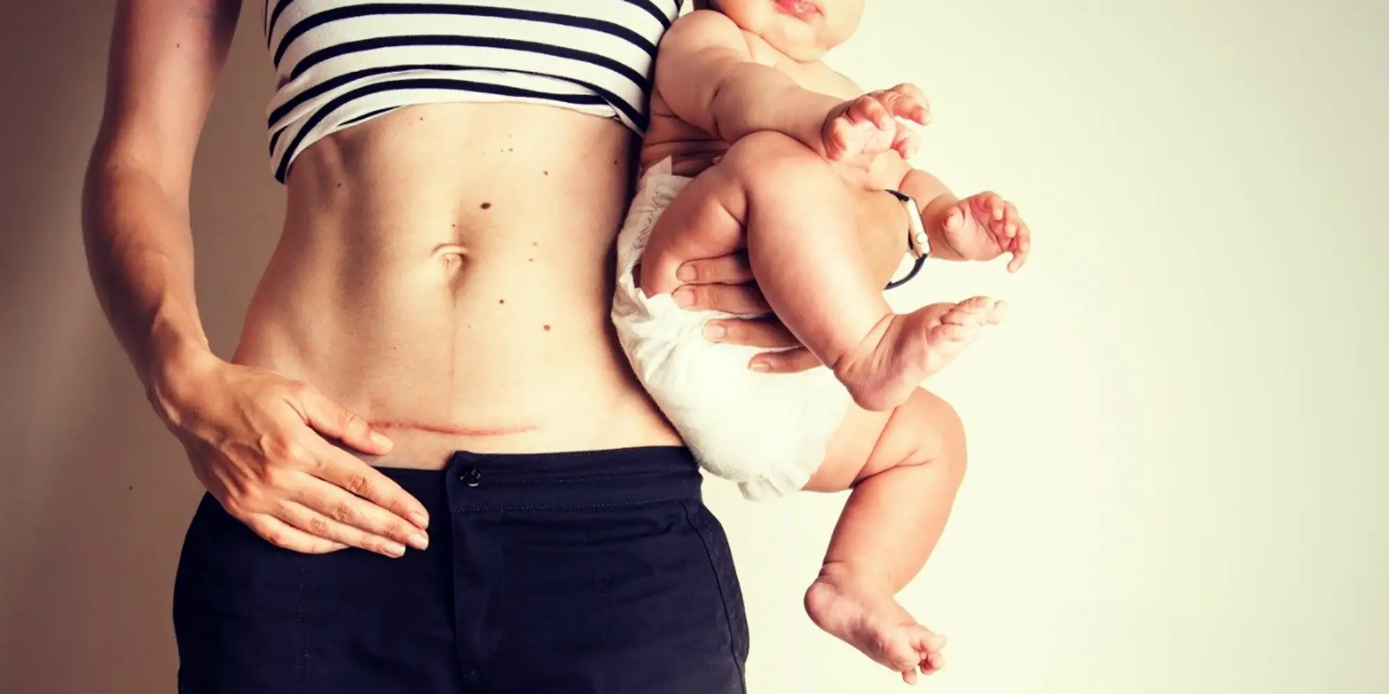 Post C-Section Recovery Guide